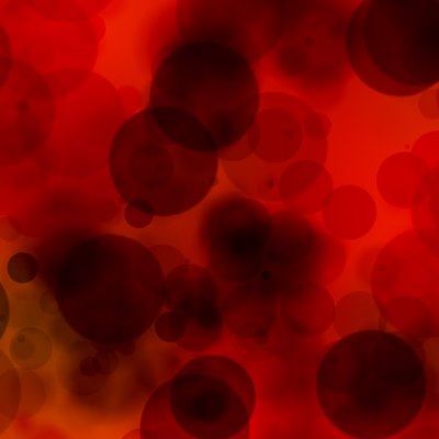 blood clots varicose veins