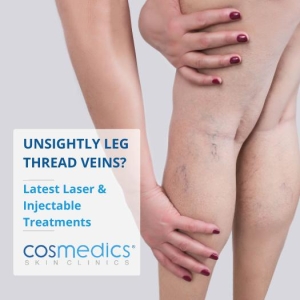 leg vein treatments