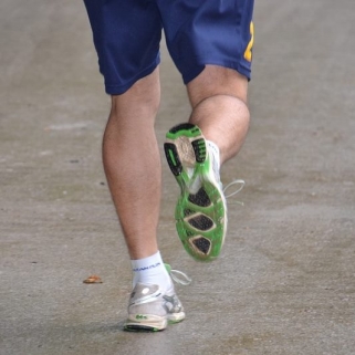 running legs varicose veins